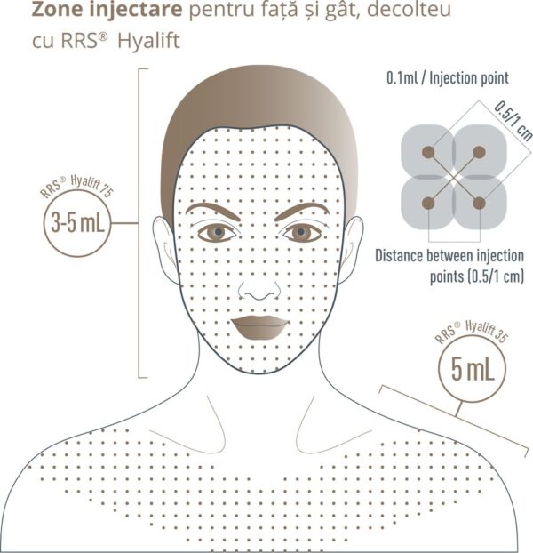RRS Hyalift 75 Proactive - tratament atrofie dermica