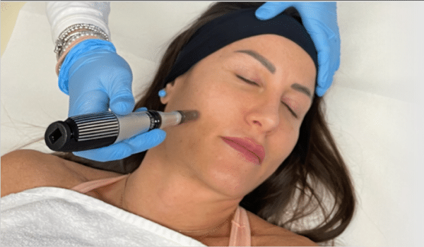 1NEED pro microneedling pen