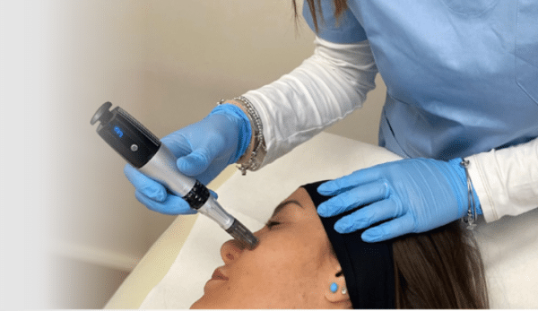 1NEED pro microneedling pen