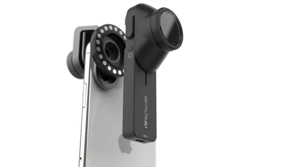 dermatoscop dl1 pentru smartphone sau tabletă