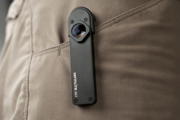 dermatoscop dl1 pentru smartphone sau tabletă