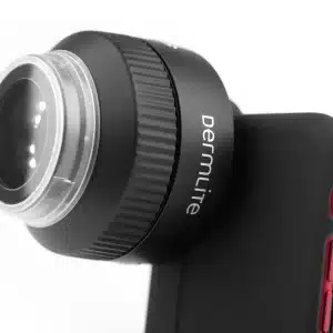 lentila dermatoscop Foto X Dermlite