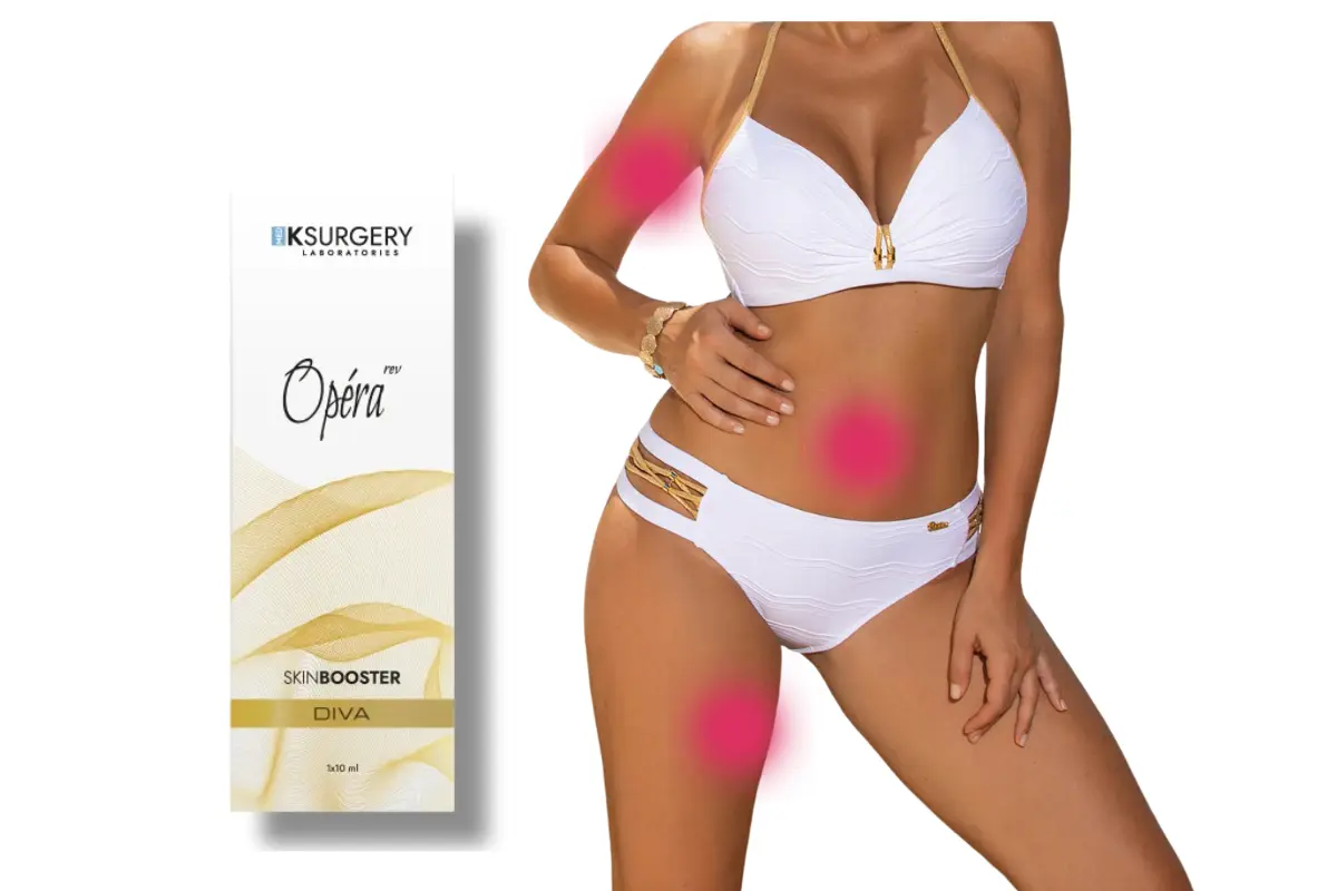 OPERA REV DIVA