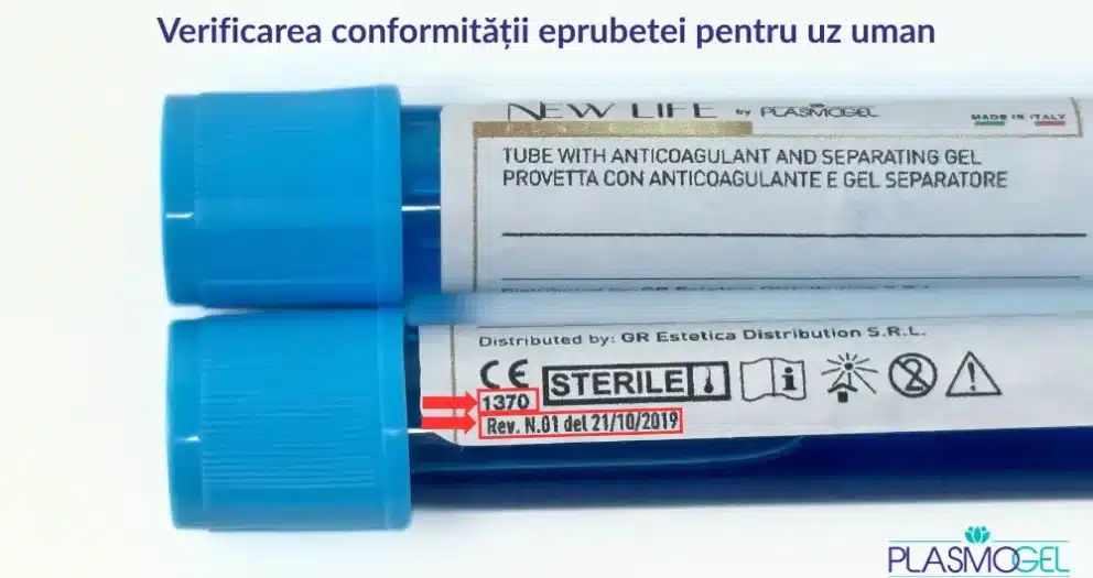 eprubete prp uz uman