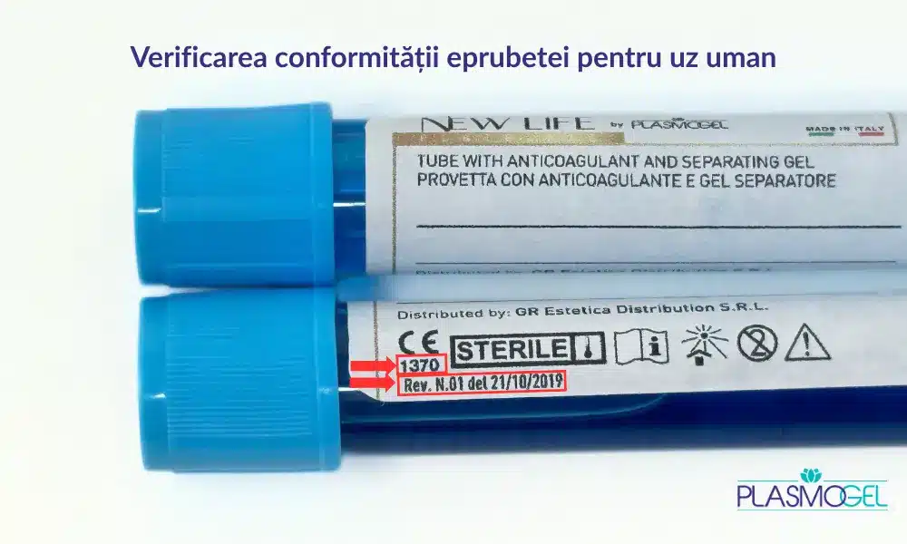 eprubete prp uz uman